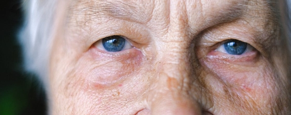 Yeux_femme_agee